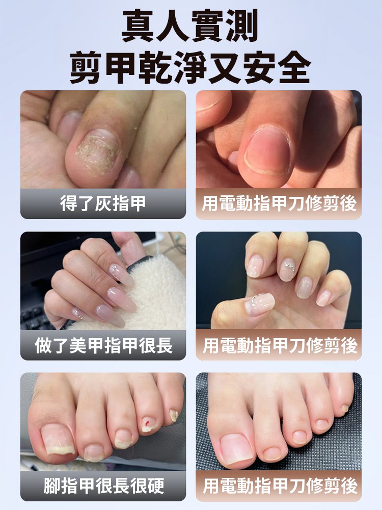 電動指甲刀