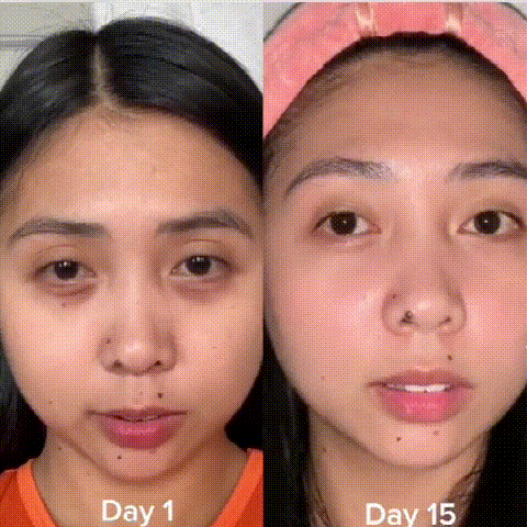 ครีมซ่อมแซมรอบดวงตาต่อต้านริ้วรอยเปปไทด์ 5D