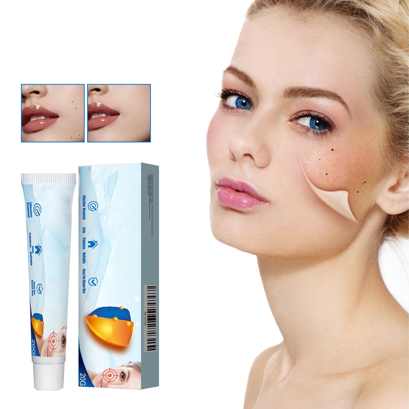 イボ取りクリーム