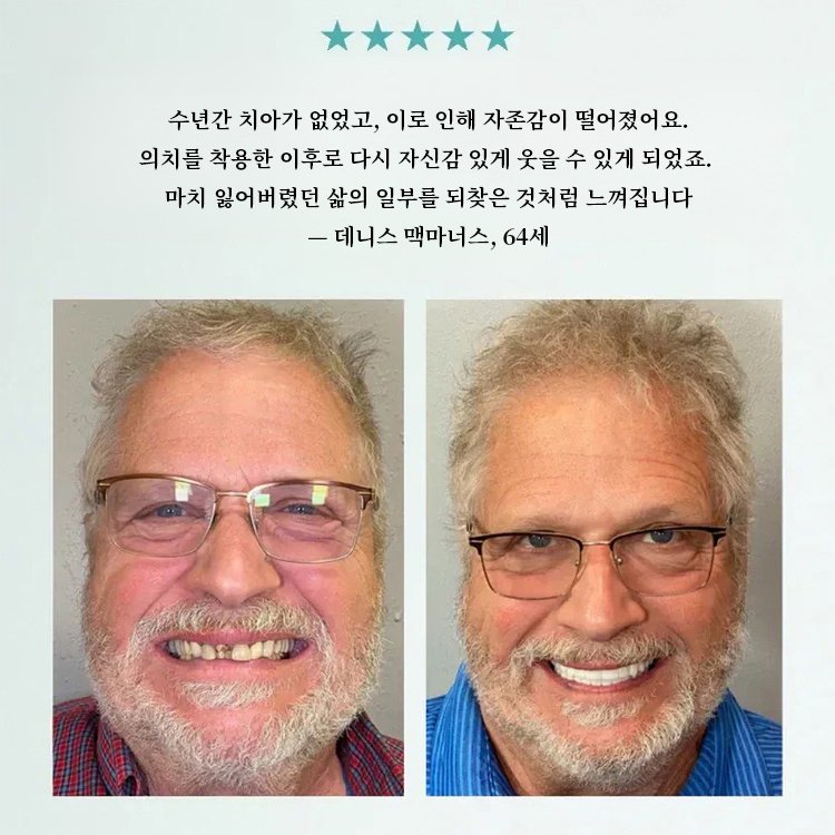 【3-in-1】미백 틀니 세트 7일 무료 체험！