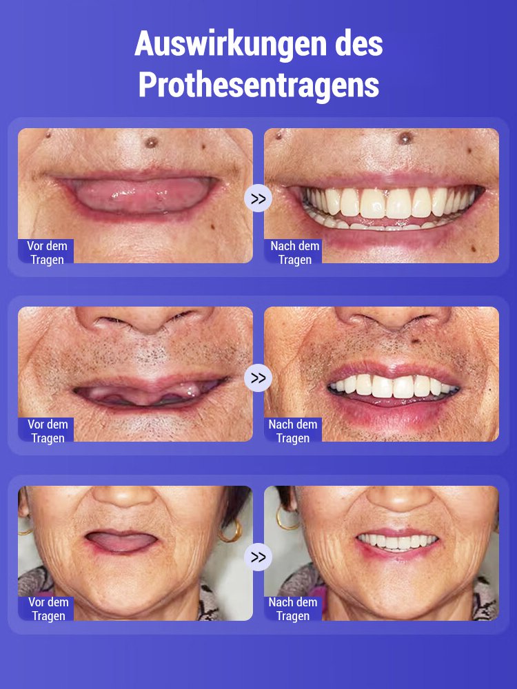 Medizinisches Patent: Schönheitsprothesen-Set