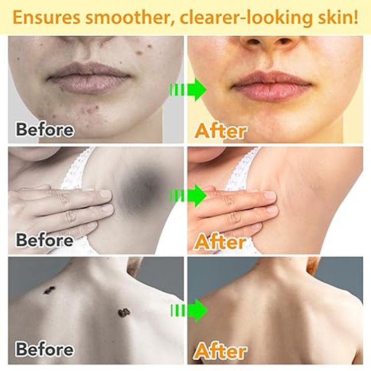 Instant Spot Cream
