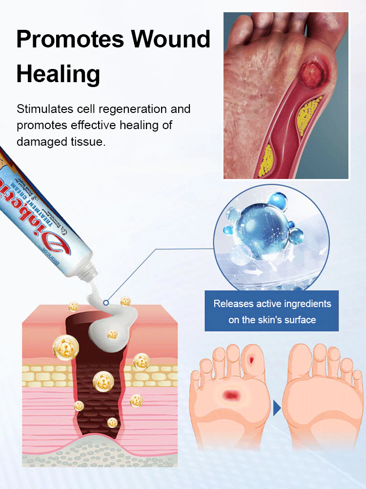 Diabetes Treatment Cream