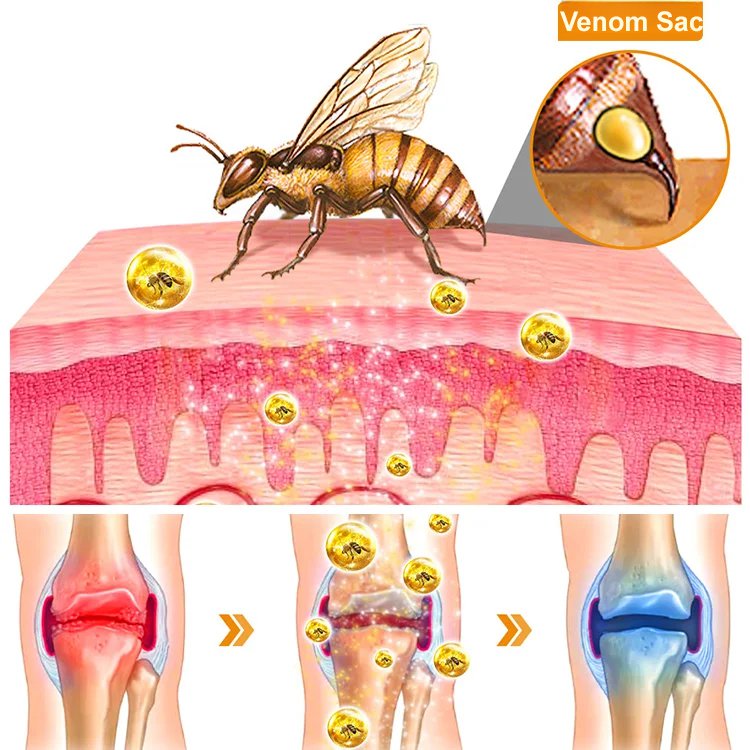 Laniska Crème Réparatrice pour Articulations au Venin d'Abeille