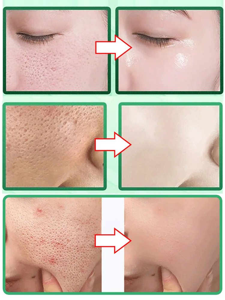 Centella Asiatica Bubble Mask