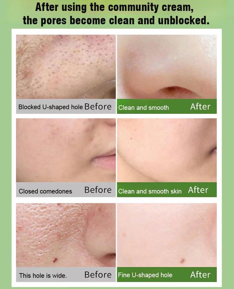 Snow Grass Bubble Mask