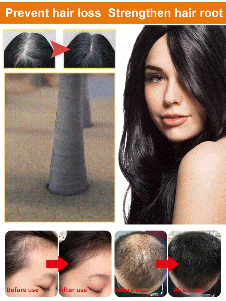 【Never lose hair】Anti-hair loss shampoo