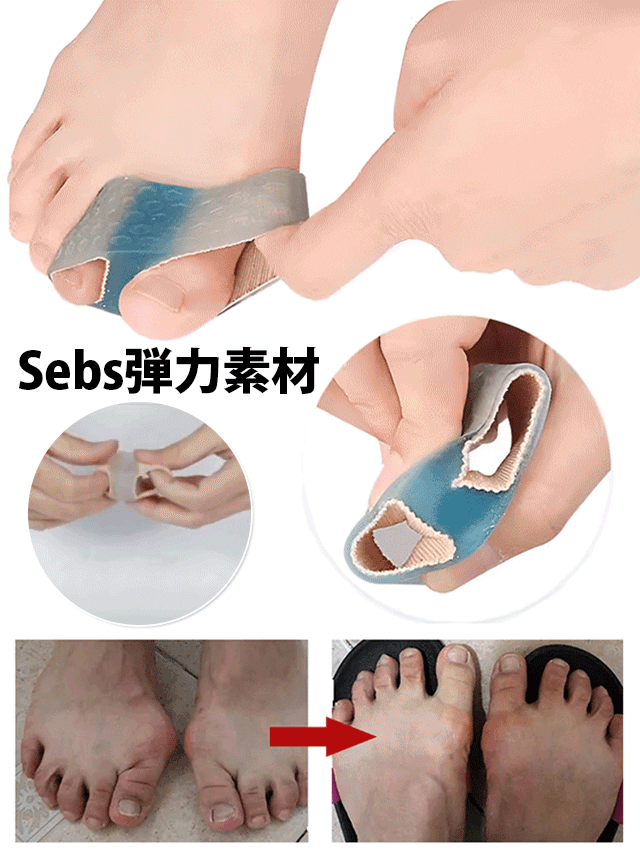 【最新モデル】外反母趾サポーター