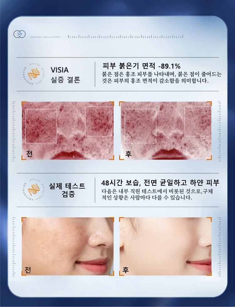 翻译件-HFH-【老斑黄斑一抹消】淡斑尿素霜-wz_18.png