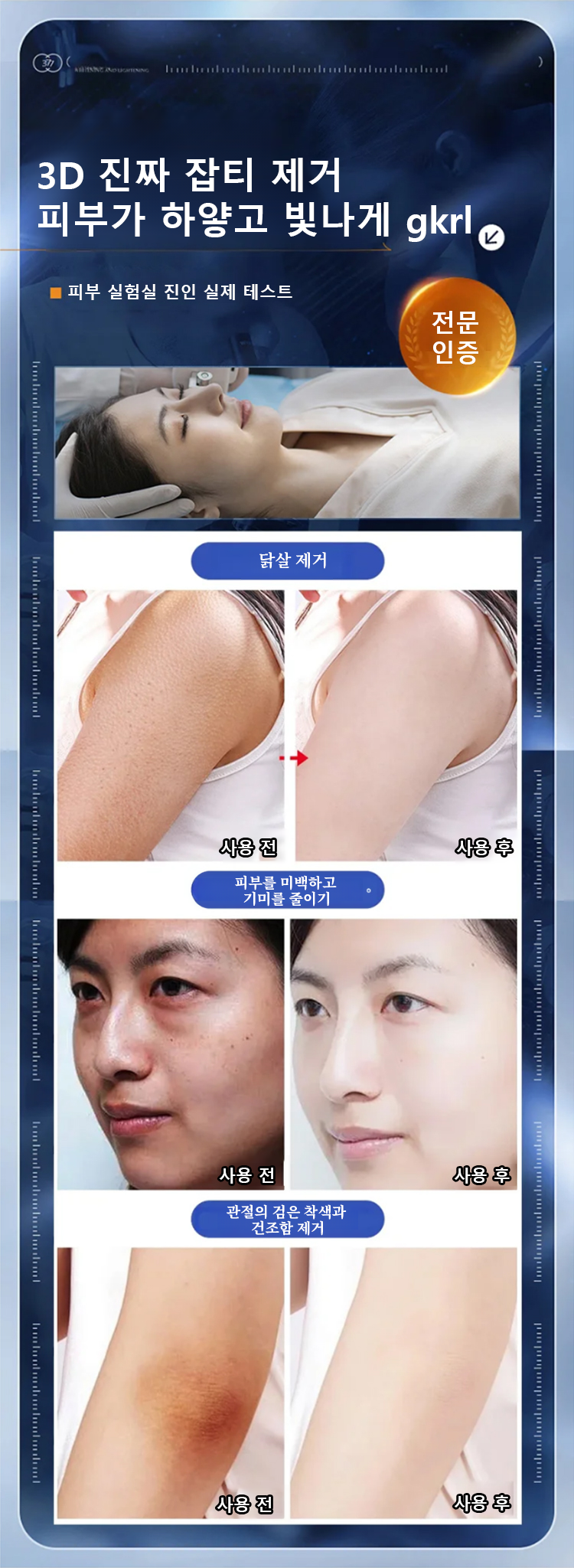 翻译件-HFH-【老斑黄斑一抹消】淡斑尿素霜-wz_15.png