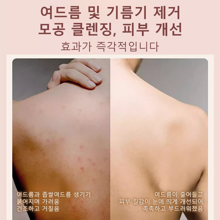 2in1 실리콘 두피 마사지 샴푸 및 목욕 브러시