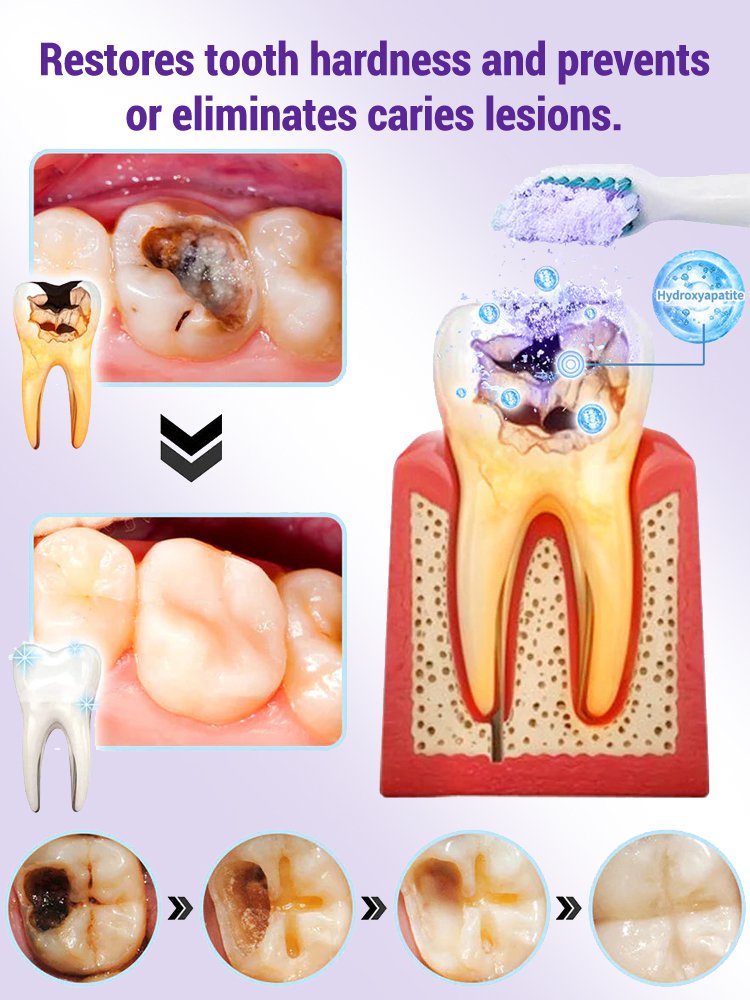 【Periodontal Health Restoration】Purple Mineral Tooth Powder for Tooth Restoration