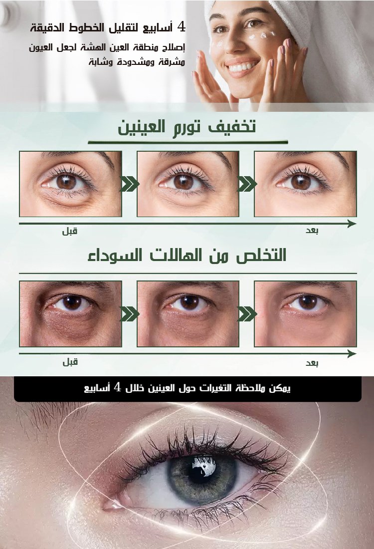 كريم عيون متعدد الفعالية لشد البشرة من EELHOE