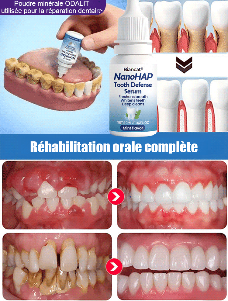 Sérum protecteur dentaire spécialisé pour la régénération de l'émail dentaire