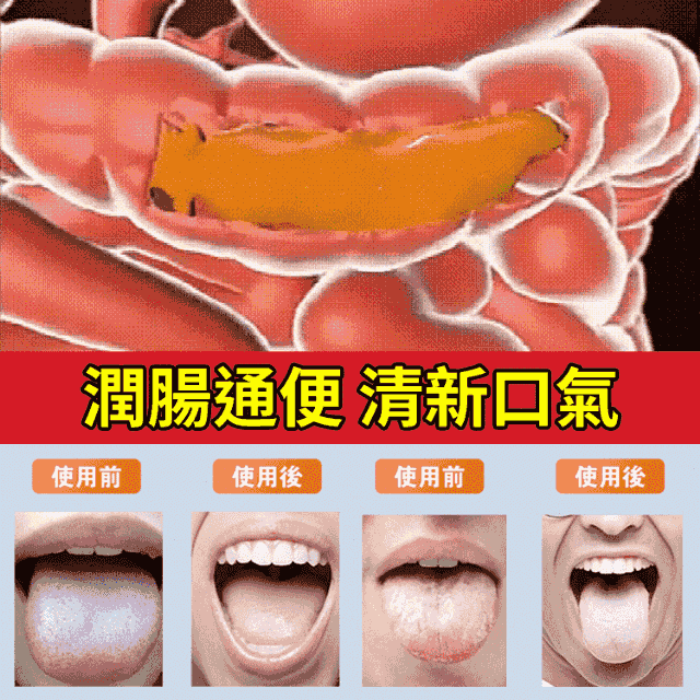 【潤腸養胃】黨參猴頭菇沙棘片 