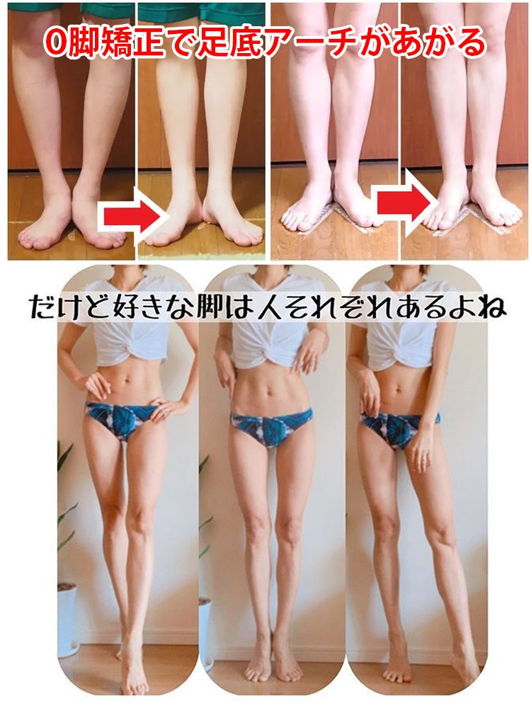 【イタリア製の本革で、通気性と滑り止め機能があり、10年間型崩れしません。】オープントゥウェッジソールサンダル