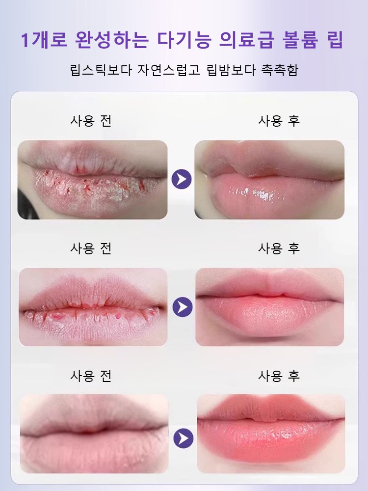 주름 완화 보습 온도 변화 립 에센스