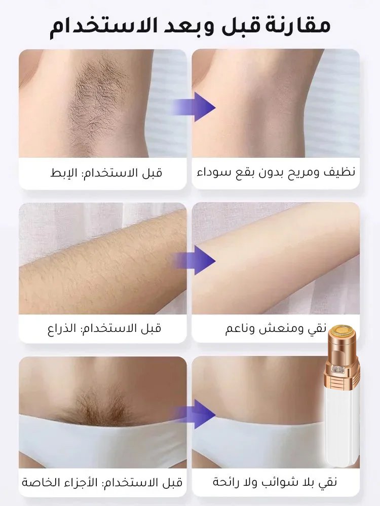  جهاز إزالة الشعر الكهربائي 