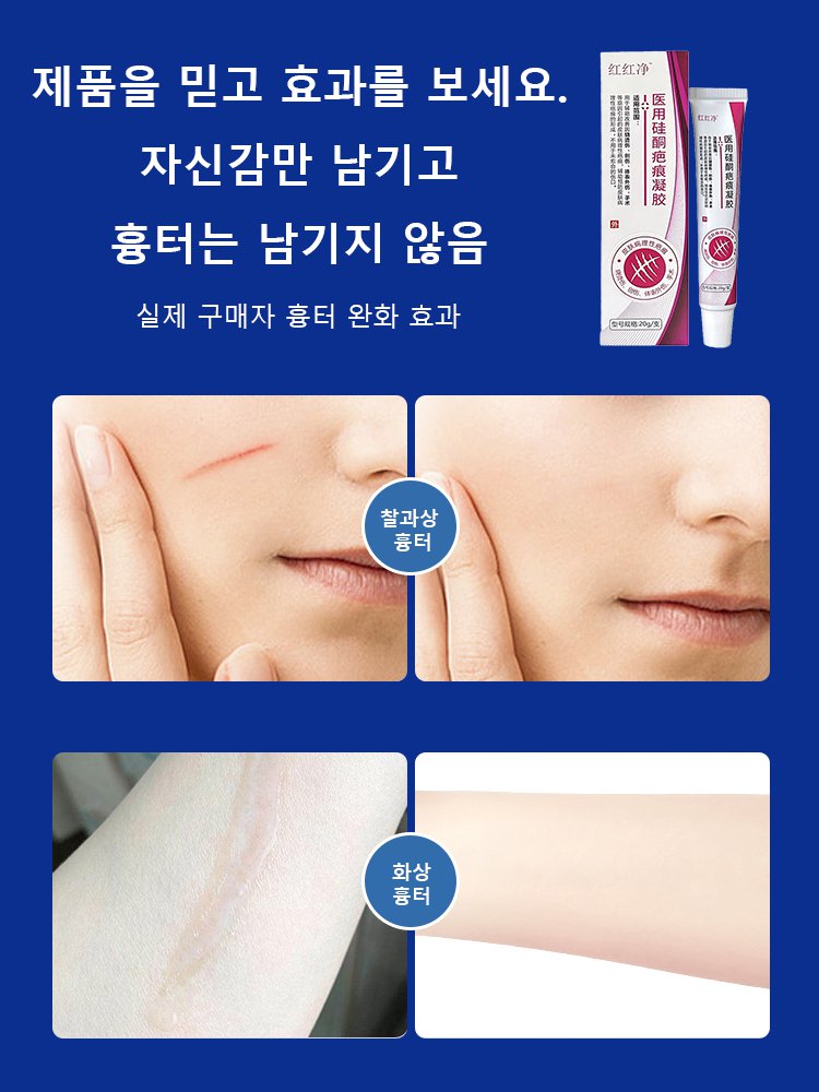 의료용 실리콘 흉터 젤