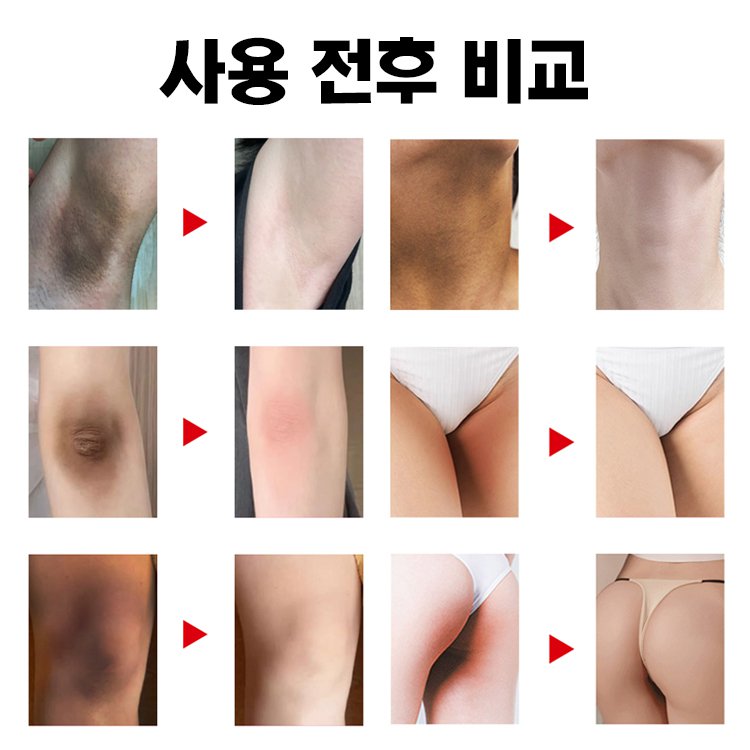 코직산 화이트닝 비누