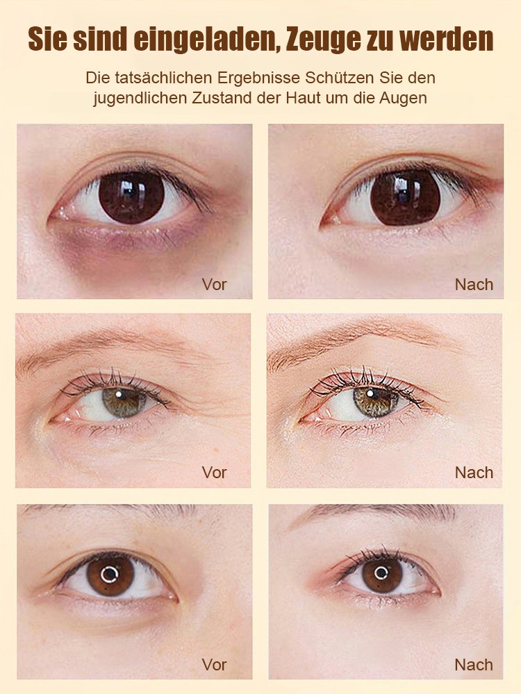 Dinkiss Lutein Augenserum gegen feine Linien