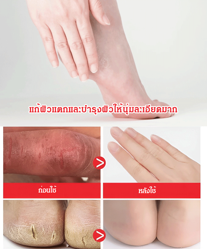 น้ำมันม้าทามือให้ความชุ่มชื้นและป้องกันการแตกร้าว