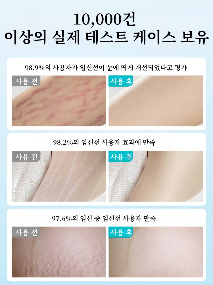 24시간 지속 흉터 완화 실리콘 젤 흉터 패치