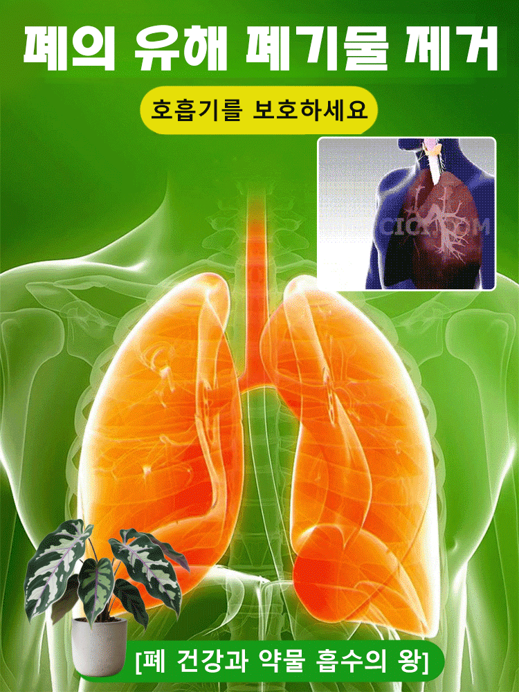 【다양한 색상 선택 가능】칼라듐 원예 씨앗