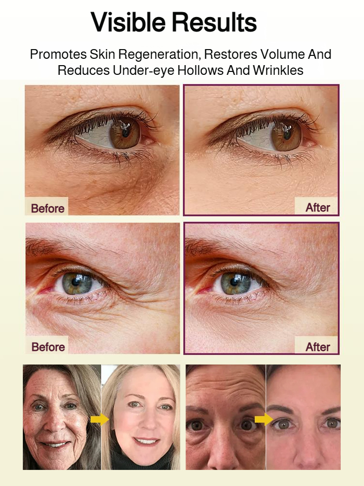 Moisturizing Anti-Wrinkle Treatment Stick