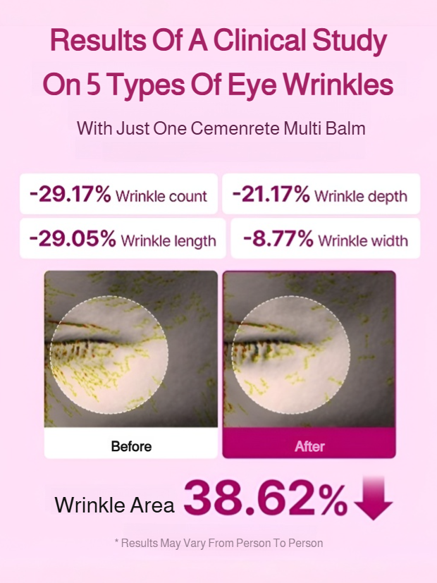 Moisturizing Anti-Wrinkle Treatment Stick