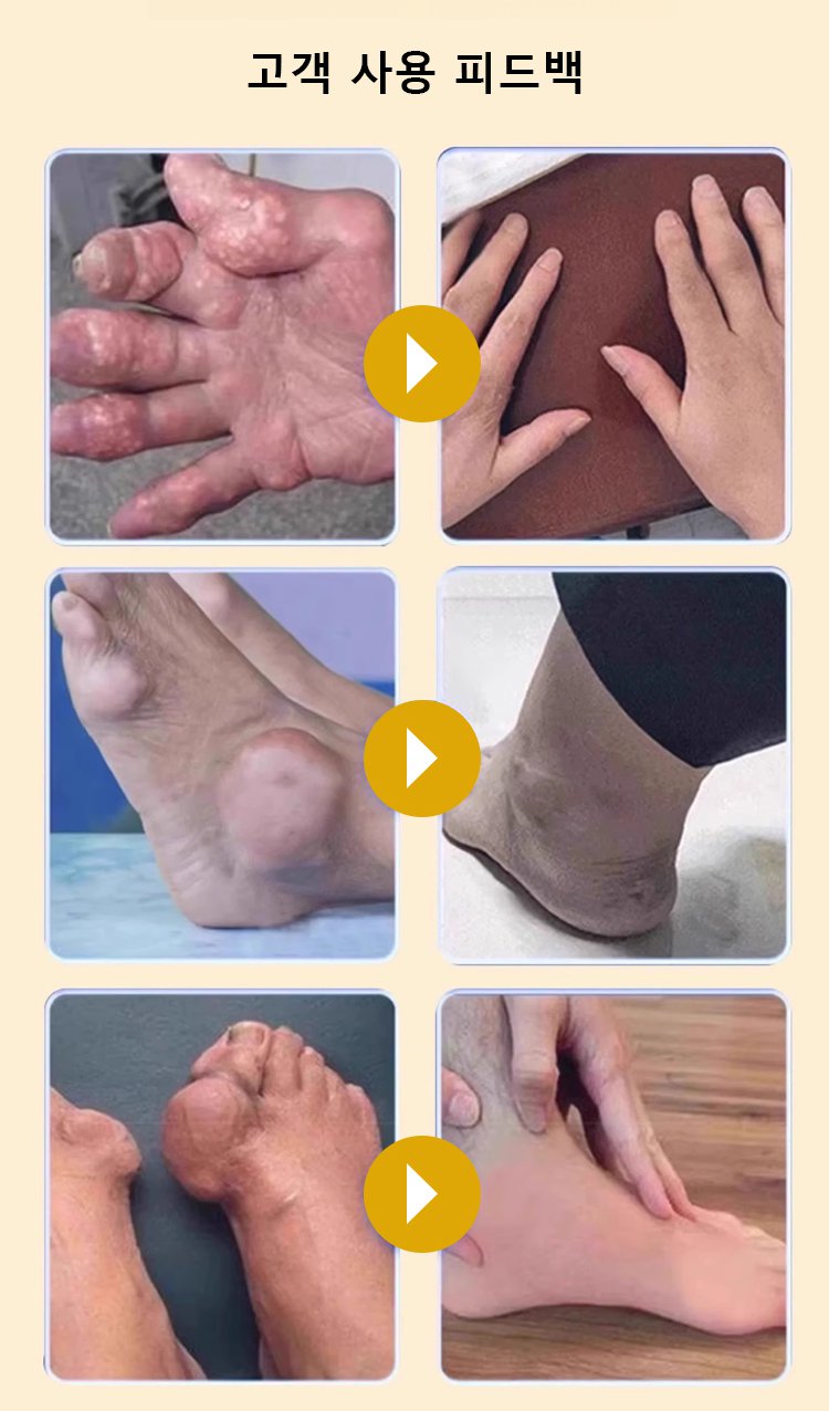 翻译件-JC-关节疼痛贴-1250852_10.jpg