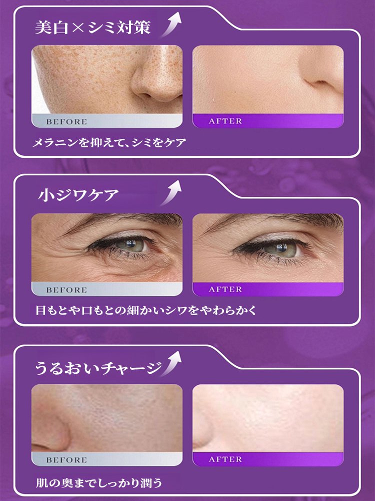 シワ取りアンチエイジングエッセンス