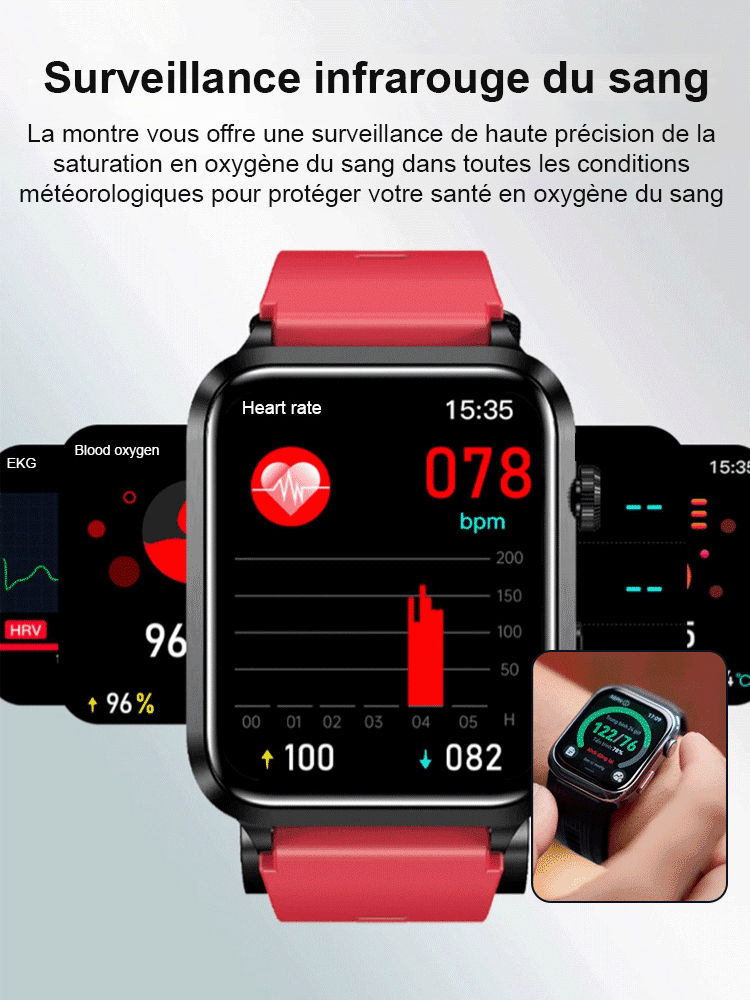 Montre intelligente de surveillance non invasive de la glycémie, de l'ECG et de la pression artériel