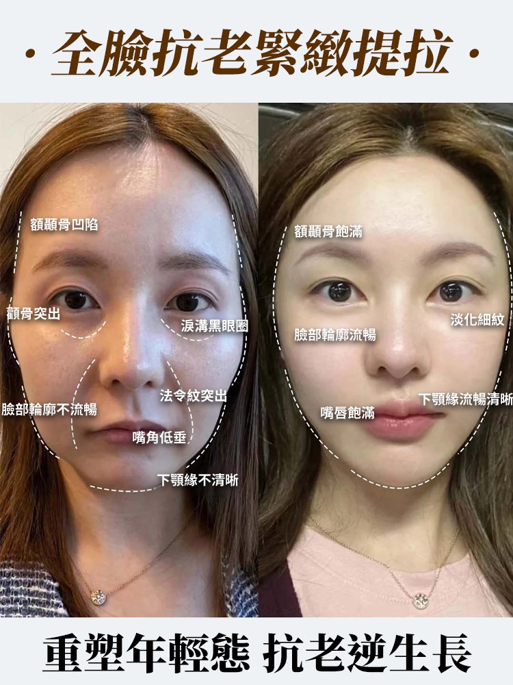 重組膠原抗皺乳霜抗皺淡紋