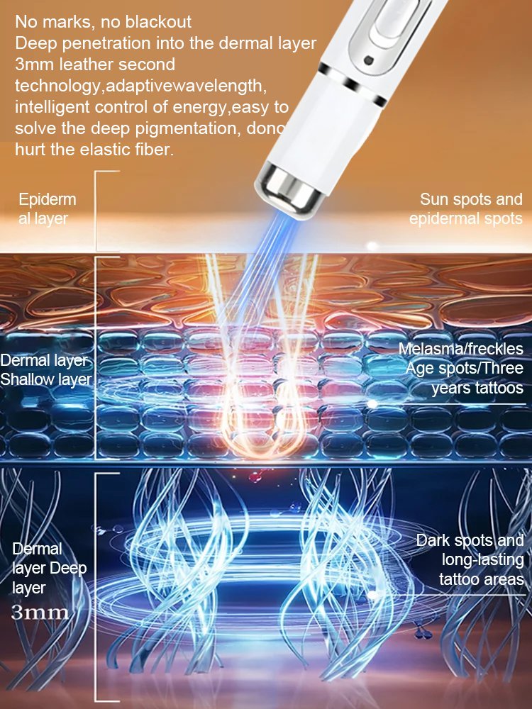 Laser-Schönheitsgerät