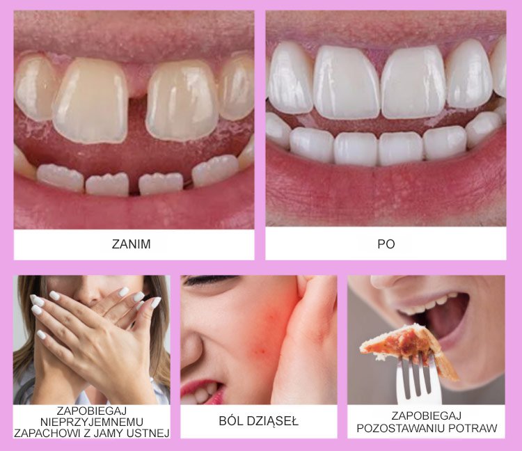 Human Food Grade Thermoplastic Denture Adhesive 20 Untitled-1_03.jpg