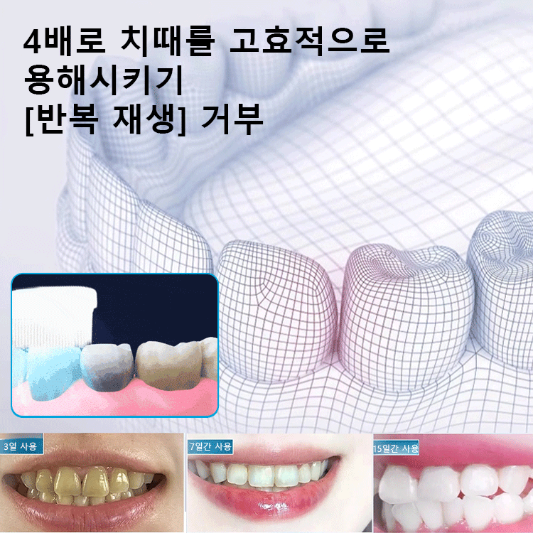 [입냄새 제거 및 잇몸 케어] 베이킹소다 효소 화이트닝 치약