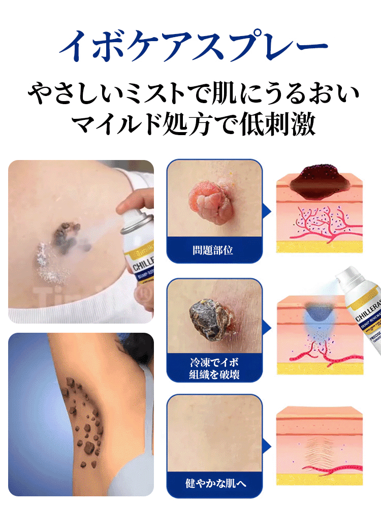 LOVILDS™ アイスクール肌修復スプレー