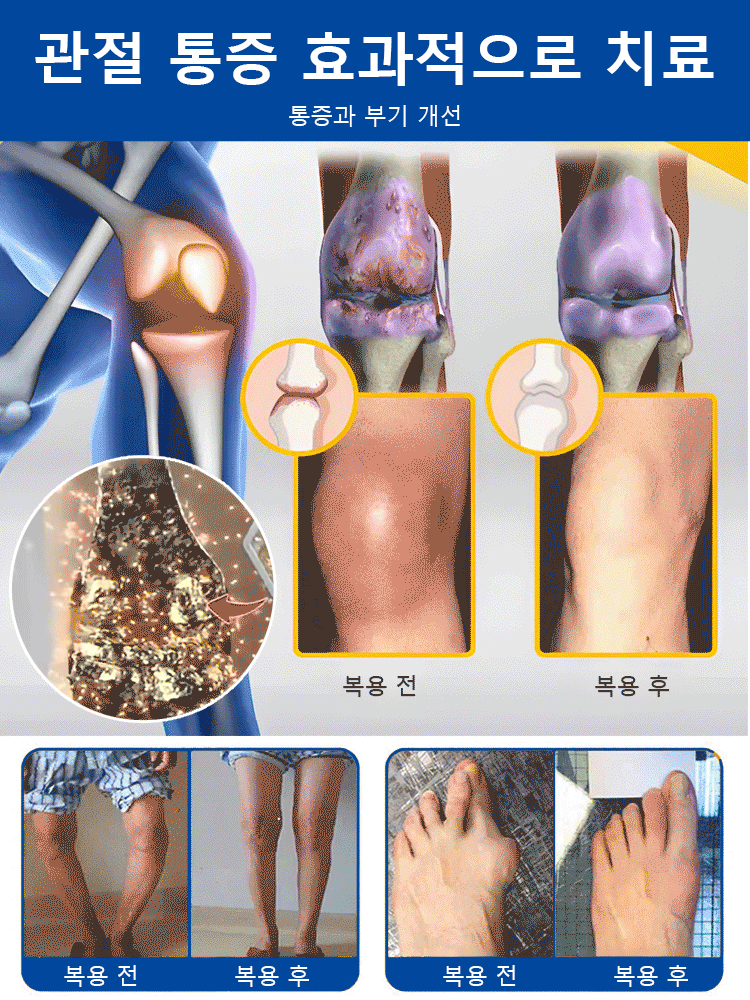[판매량 1위】관절 연골 캡슐