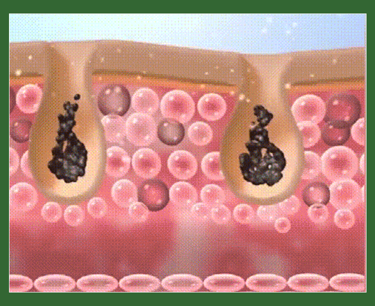 1_09.gif
