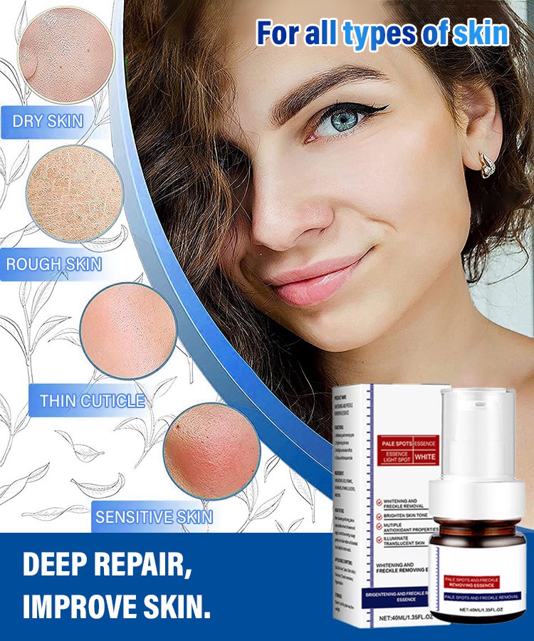 Freckle-Banishing Serum for Face: Repair and Cleanse Dark Spots