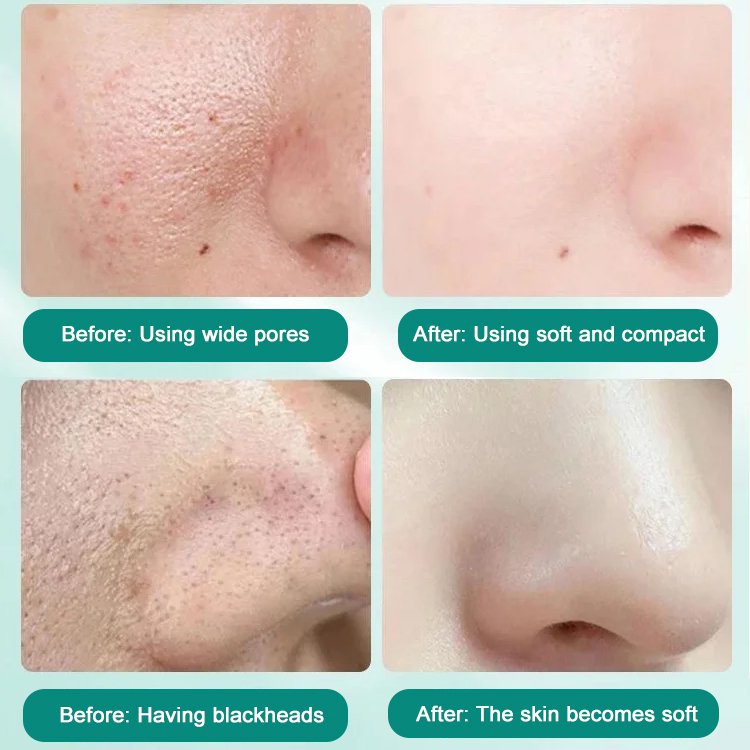 Complex Acid Avocado Cleansing Facial Bubble Mask