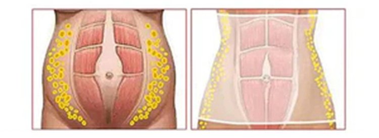 翻译件-JC-家用腹部按摩机-1250915_10.jpg