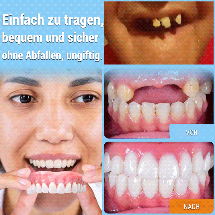 Simulation von aufhellenden Silikon-Zahnprothesen