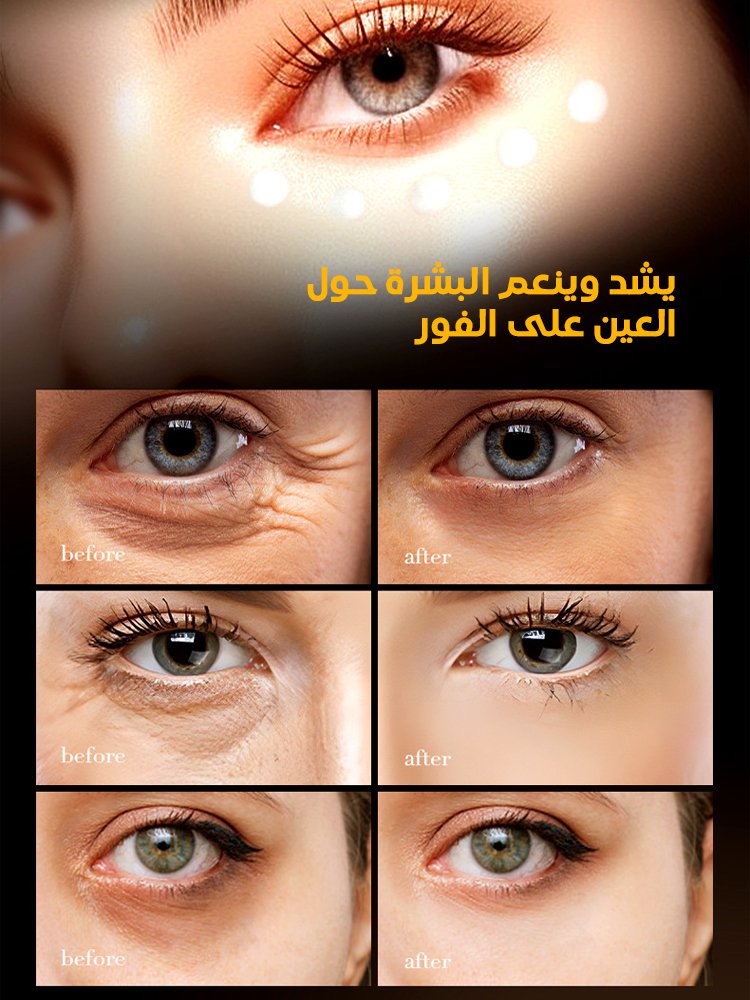 【تفتيح لون البشرة حول العين وتقليل التجاعيد】كريم عين منعش ومرطب بالكافيين