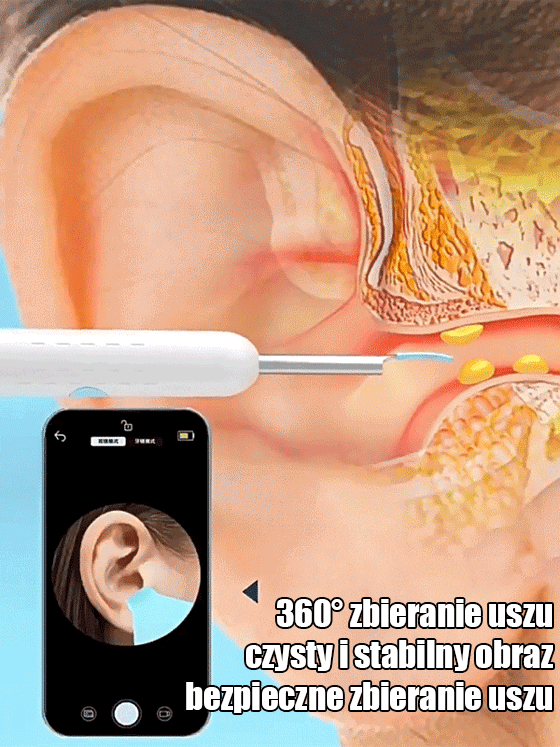 Inteligentny wizualny pręt do wybierania ucha