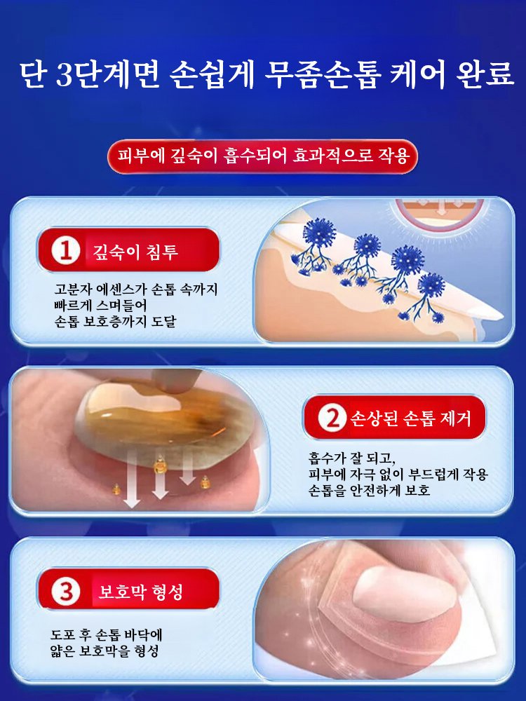 무좀 손톱 치료 에센스