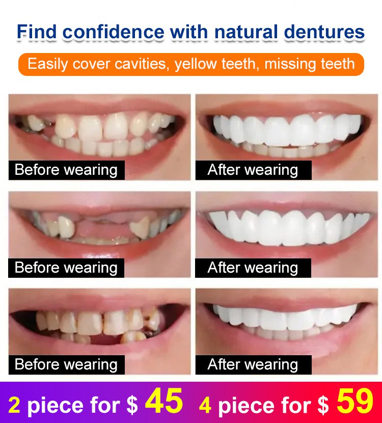 Whitening artificial teeth dentures
