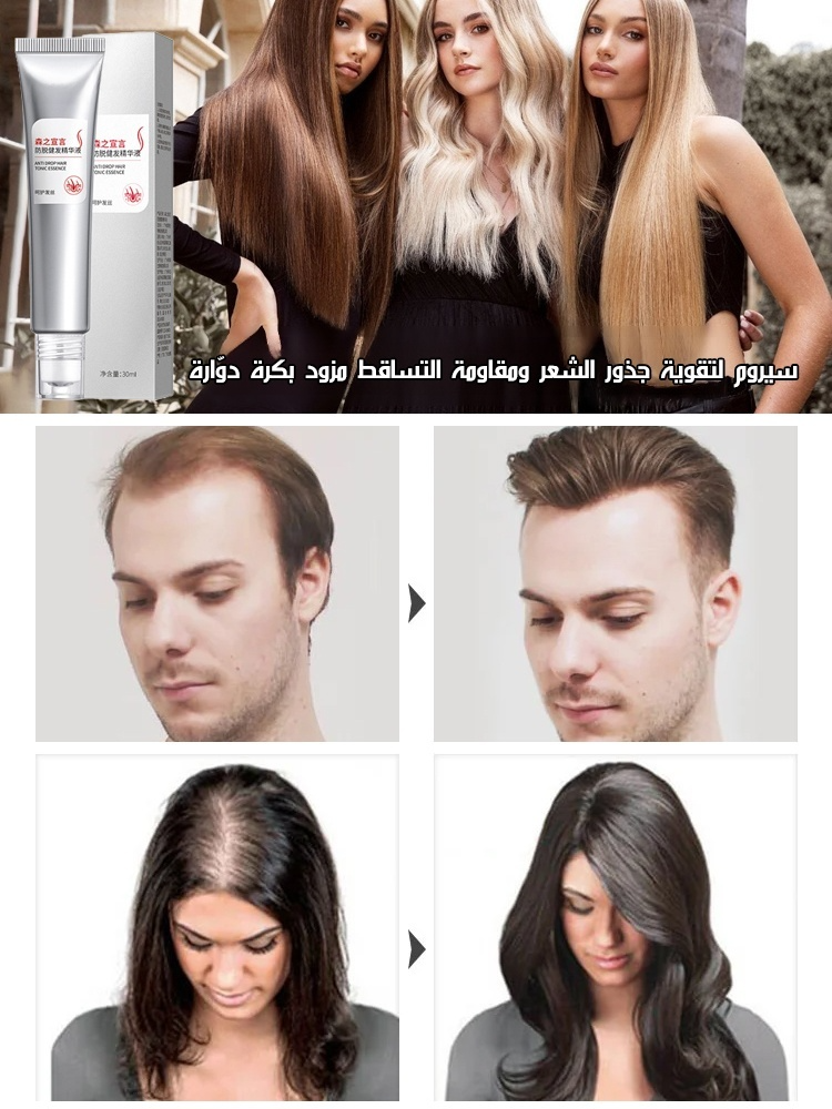 سيروم لتقوية جذور الشعر ومقاومة التساقط مزود بكرة دوّارة