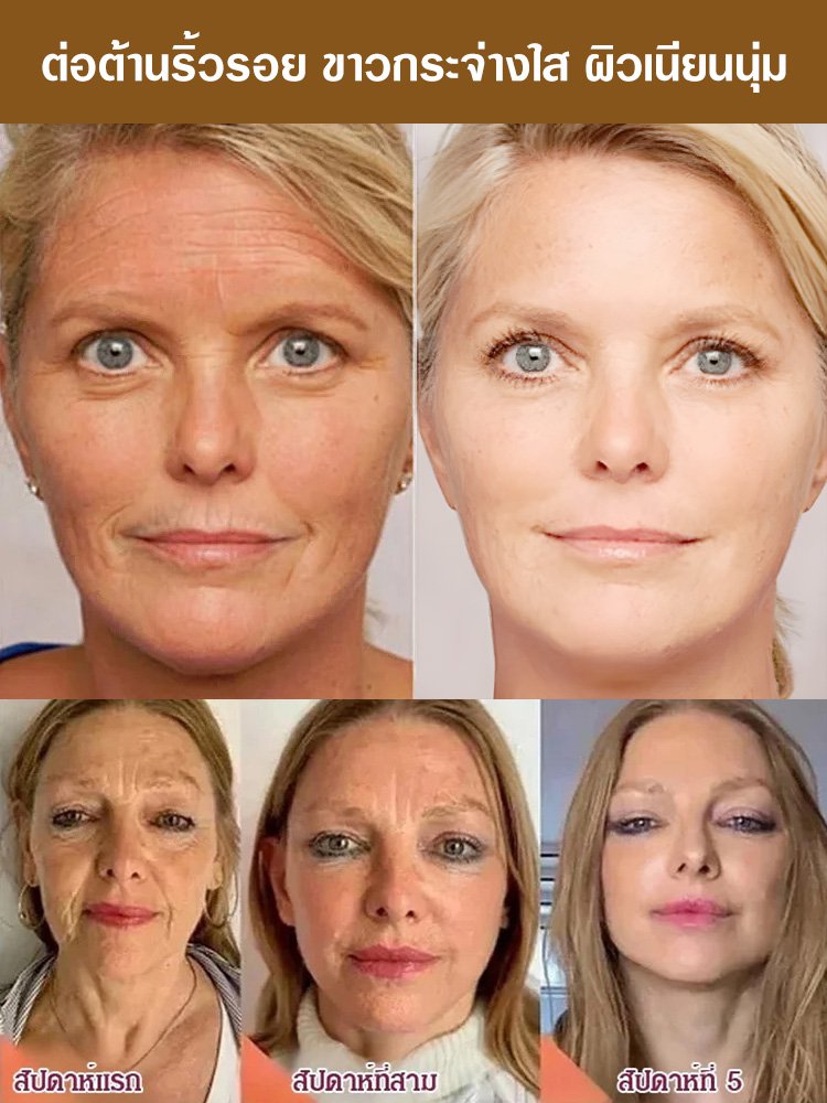 【หยดเดียวกลับสู่วัย 18 ปี】เซรั่มทองคำบริสุทธิ์